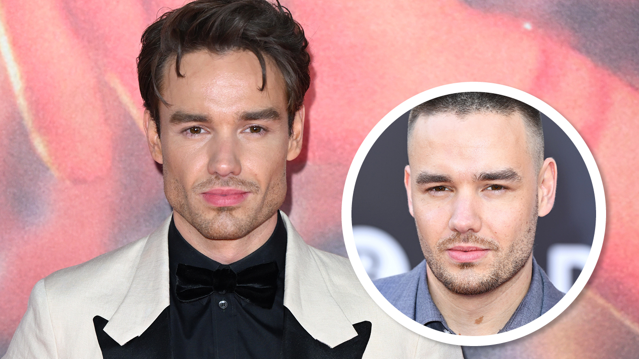 One Direction Liam Payne Surgery